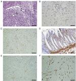 CD34 Antibody in Immunohistochemistry (IHC)