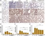 FAP Antibody in Immunohistochemistry (IHC)