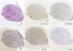 Calcium Sensing Receptor Antibody in Immunohistochemistry (IHC)