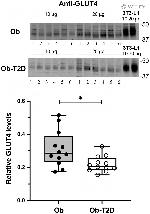 GLUT4 Antibody in Western Blot (WB)