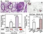 IL-13 Antibody in Neutralization (Neu)