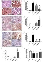 Bcl-2 Antibody in Immunohistochemistry (IHC)