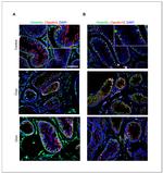 Claudin 18 Antibody in Immunohistochemistry (IHC)