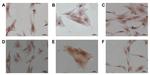 SDF1 Antibody in Immunocytochemistry (ICC/IF)