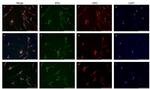 Estrogen Receptor alpha Antibody in Immunocytochemistry (ICC/IF)