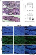 Desmin Antibody in Immunohistochemistry (IHC)