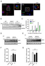 TIRAP Antibody in Immunocytochemistry (ICC/IF)