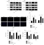 MITD1 Antibody in Western Blot (WB)