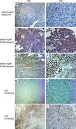 Phospho-EGFR (Tyr1197) Antibody in Immunohistochemistry (IHC)