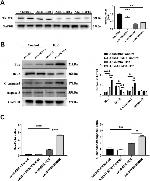 TRIM38 Antibody in Western Blot (WB)