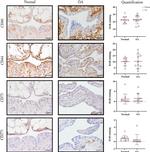 CD44 Antibody in Immunohistochemistry (IHC)