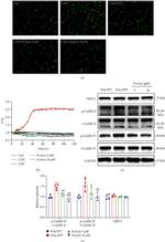 Phospho-CaMKII beta/gamma/delta (Thr287) Antibody in Western Blot (WB)