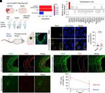 Thrombospondin-1 Antibody in Immunohistochemistry (IHC)