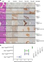 Cytokeratin 5 Antibody in Immunohistochemistry (IHC)