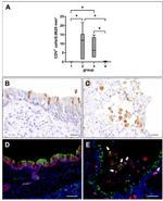 IBA1 Antibody in Immunohistochemistry (IHC)