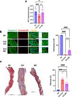 Cardiac Troponin T Antibody in Immunohistochemistry (IHC)