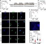 Lamin A Antibody in Immunocytochemistry (ICC/IF)