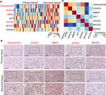 HOXC6 Antibody in Immunohistochemistry (IHC)