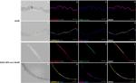 PMEL Antibody in Immunohistochemistry (IHC)