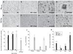 beta Amyloid Antibody in Immunohistochemistry (IHC)