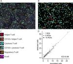 FOXP3 Antibody in Immunohistochemistry (IHC)