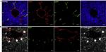 LYVE1 Antibody in Immunohistochemistry (IHC)