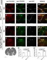 VEGF Receptor 3 Antibody in Immunohistochemistry (IHC)