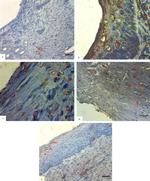 TGF beta-1 Antibody in Immunohistochemistry (IHC)