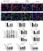 Connexin 32 Antibody in Western Blot (WB)