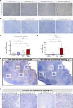 Granzyme B Antibody in Immunohistochemistry (IHC)