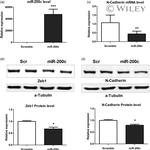 ZEB1 Antibody in Western Blot (WB)