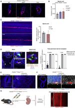 SOX2 Antibody in Immunohistochemistry (IHC)