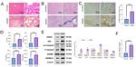 PYCARD Antibody in Western Blot (WB)