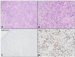 Nkx2.1 Antibody in Immunohistochemistry (IHC)