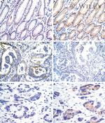 E-Cadherin Antibody in Immunohistochemistry (IHC)