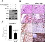 E-Cadherin Antibody in Immunohistochemistry (IHC)