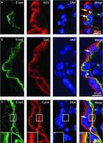 E-Cadherin Antibody in Immunohistochemistry (IHC)