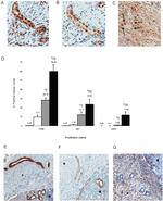 E-Cadherin Antibody in Immunohistochemistry (IHC)