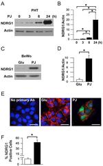 E-Cadherin Antibody in Immunocytochemistry (ICC/IF)