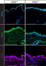 E-Cadherin Antibody in Immunohistochemistry (IHC)