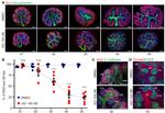 E-Cadherin Antibody in Immunocytochemistry (ICC/IF)