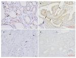 E-Cadherin Antibody in Immunohistochemistry (IHC)