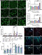 VE-cadherin Antibody in Immunohistochemistry (IHC)