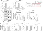 AKT Pan Antibody in Western Blot (WB)