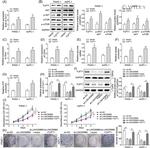 AKT Pan Antibody in Western Blot (WB)