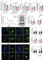 beta Amyloid Antibody in Western Blot (WB)