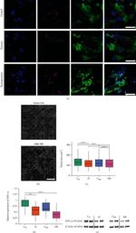 HIF1A Antibody in Western Blot, Immunocytochemistry (WB, ICC/IF)