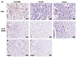 HLA-G Antibody in Immunohistochemistry (IHC)