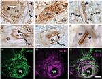 S100 Antibody in Immunohistochemistry (IHC)