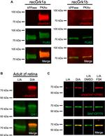 GRK1 Antibody in Western Blot (WB)